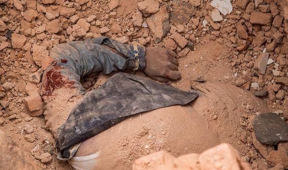 Deprem Sonrası Yaşanabilecek Sendromlar İçin Uzmanlardan Son Dakika Uyarıları Geldi: Crush Sendromu Nedir? Belirtilerini Tek Tek Açıkladılar