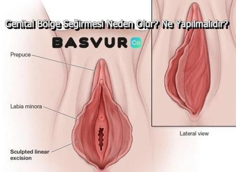Genital Bölge Seyirmesi (Seğirmesi) Neden Olur? Ne Yapılmalıdır?