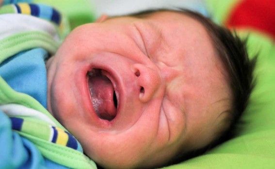 Bebeklerde Yüz Felci Nedir? Belirtileri, Tedavisi