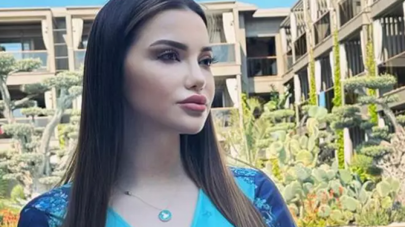 Esra Ezmeci’ye Gelen Mesajlar Yok Artık Dedirtti! Bu Kez Gelen Mesaj…