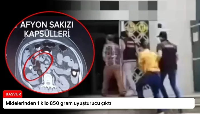 Midelerinden 1 kilo 850 gram uyuşturucu çıktı