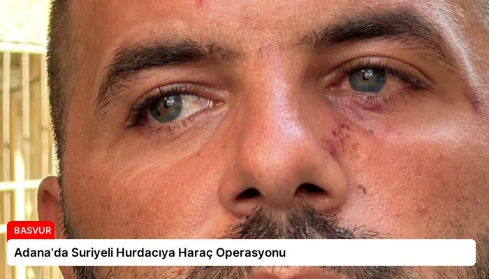 Adana’da Suriyeli Hurdacıya Haraç Operasyonu