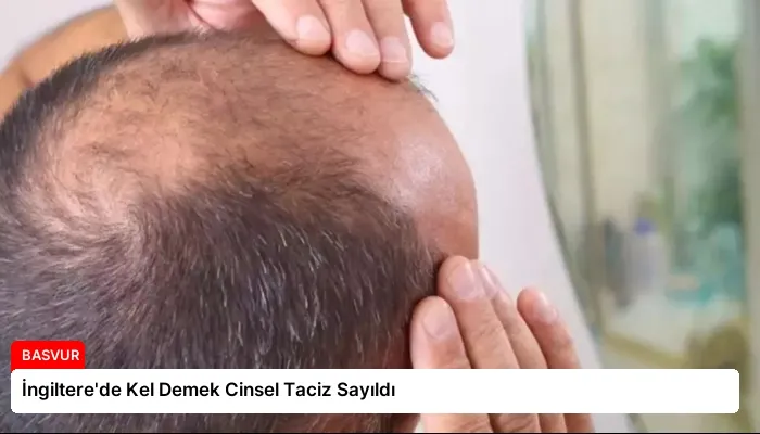 İngiltere’de Kel Demek Cinsel Taciz Sayıldı