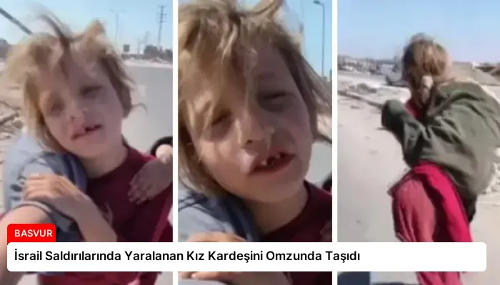 İsrail Saldırılarında Yaralanan Kız Kardeşini Omzunda Taşıdı