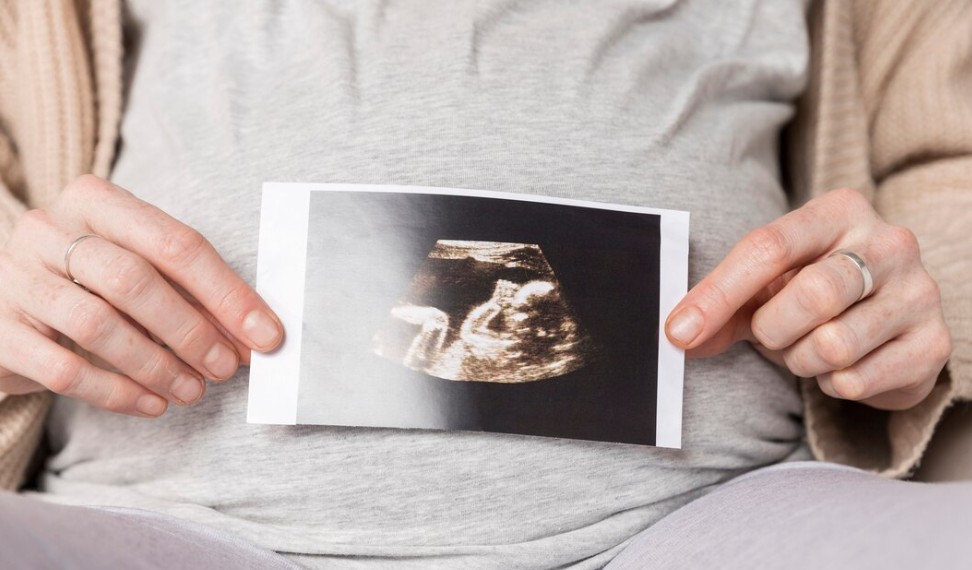 Doç. Dr. Eser Çolak İle İzmir’de Tüp Bebek Tedavisi