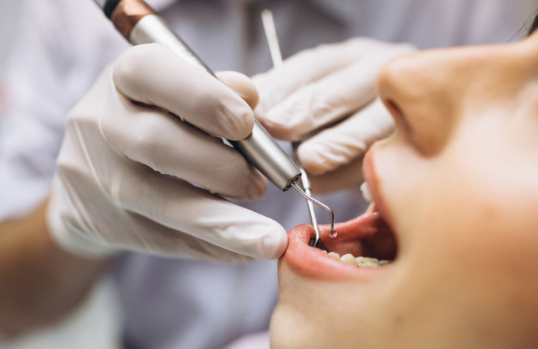 Diş Sağlığında Yeni Dönem Endodonti ile Sağlıklı Gülüşler