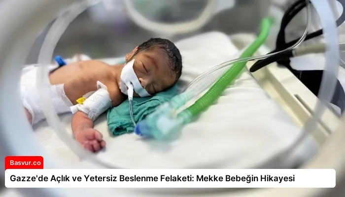 Gazze’de Açlık ve Yetersiz Beslenme Felaketi: Mekke Bebeğin Hikayesi