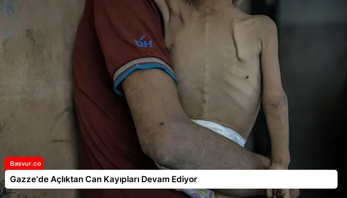Gazze’de Açlıktan Can Kayıpları Devam Ediyor