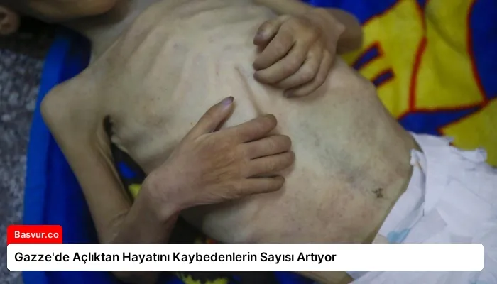 Gazze’de Açlıktan Hayatını Kaybedenlerin Sayısı Artıyor