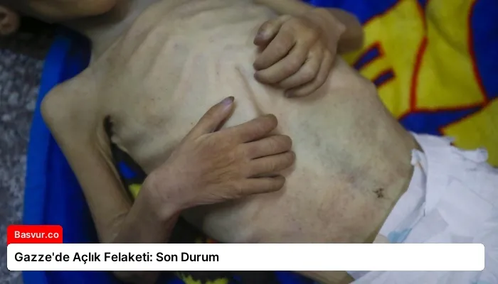 Gazze’de Açlık Felaketi: Son Durum