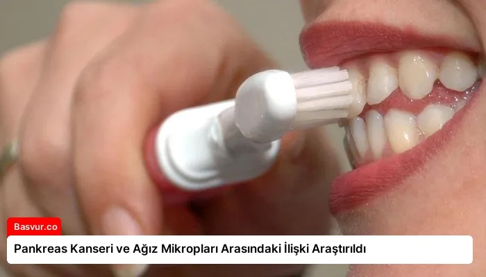 Pankreas Kanseri ve Ağız Mikropları Arasındaki İlişki Araştırıldı